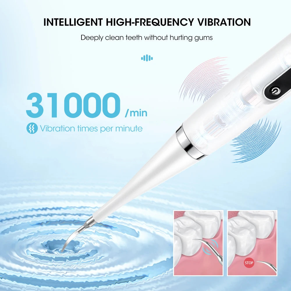 High-Frequency Sonic Electric Teeth Cleaner – Whitening, Plaque & Tartar Removal for a Brighter, Healthier Smile